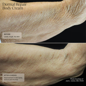 Senté Dermal Repair Body Cream 177 ml