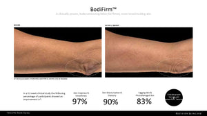 Revision Skincare Bodifirm Before and After