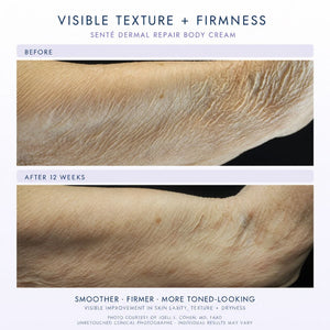 Before-and-after skin comparison showing visible texture and firmness improvement after 12 weeks of use of a dermal repair body cream. The top panel is labeled 'Before' and shows dry, textured skin; the bottom panel is labeled 'After 12 weeks' and shows smoother, firmer skin.