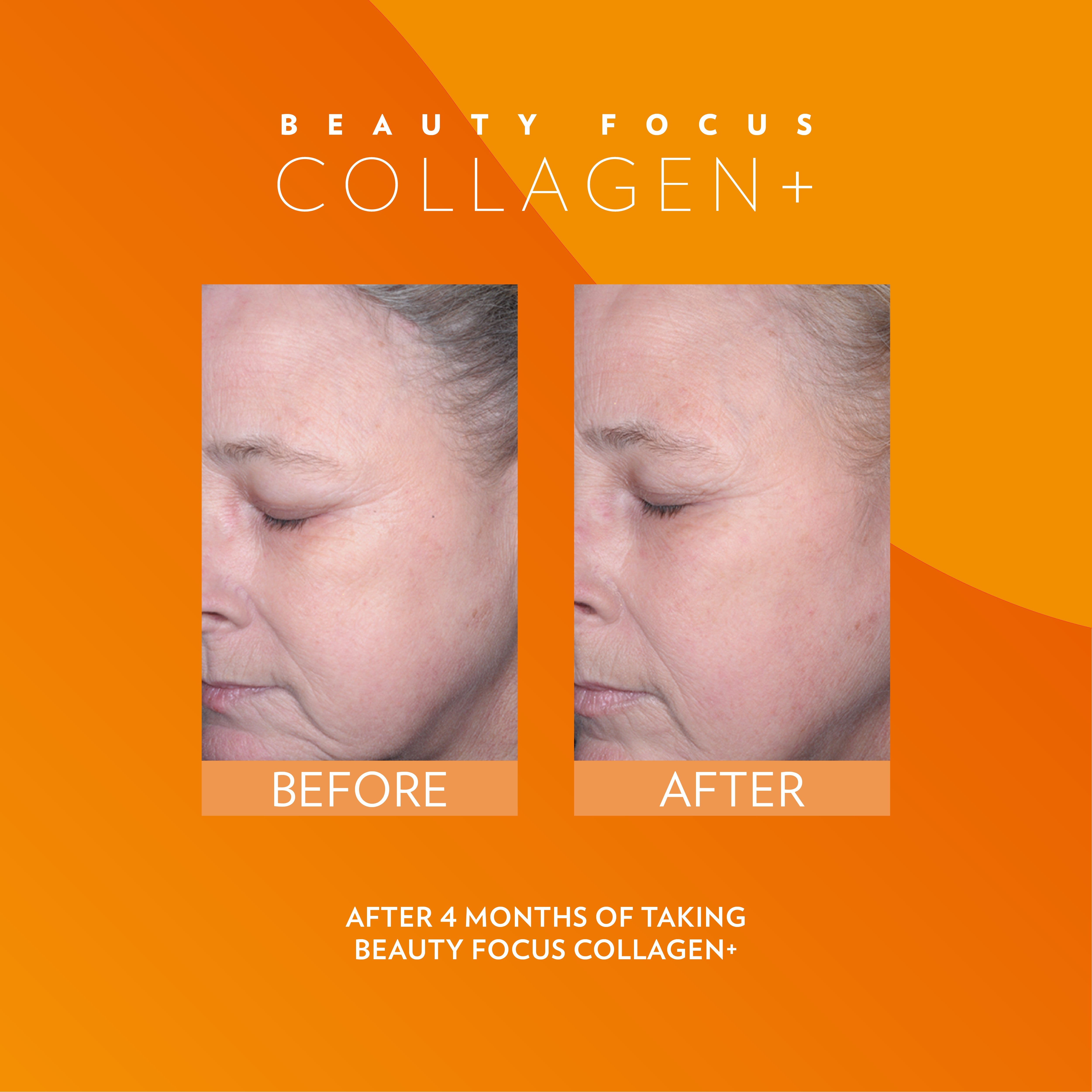 Before and after comparison of a person's face with 'Beauty Focus Collagen+' branding on an orange background.