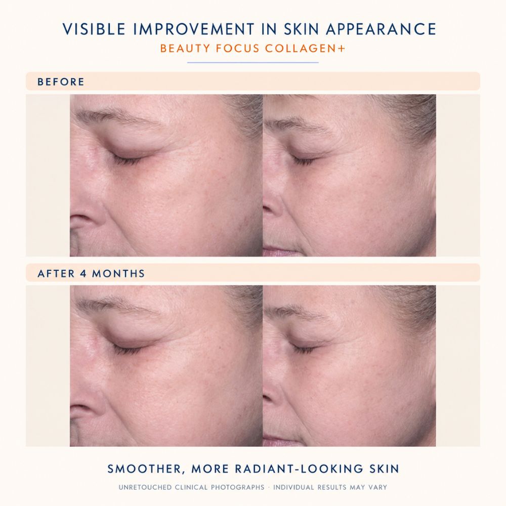 Before-and-after skincare comparison showing close-up views of a woman's face and eye area, with text reading 'VISIBLE IMPROVEMENT IN SKIN APPEARANCE,' 'BEAUTY FOCUS COLLAGEN+,' 'BEFORE,' 'AFTER 4 MONTHS,' and 'SMOOTHER, MORE RADIANT-LOOKING SKIN.'.