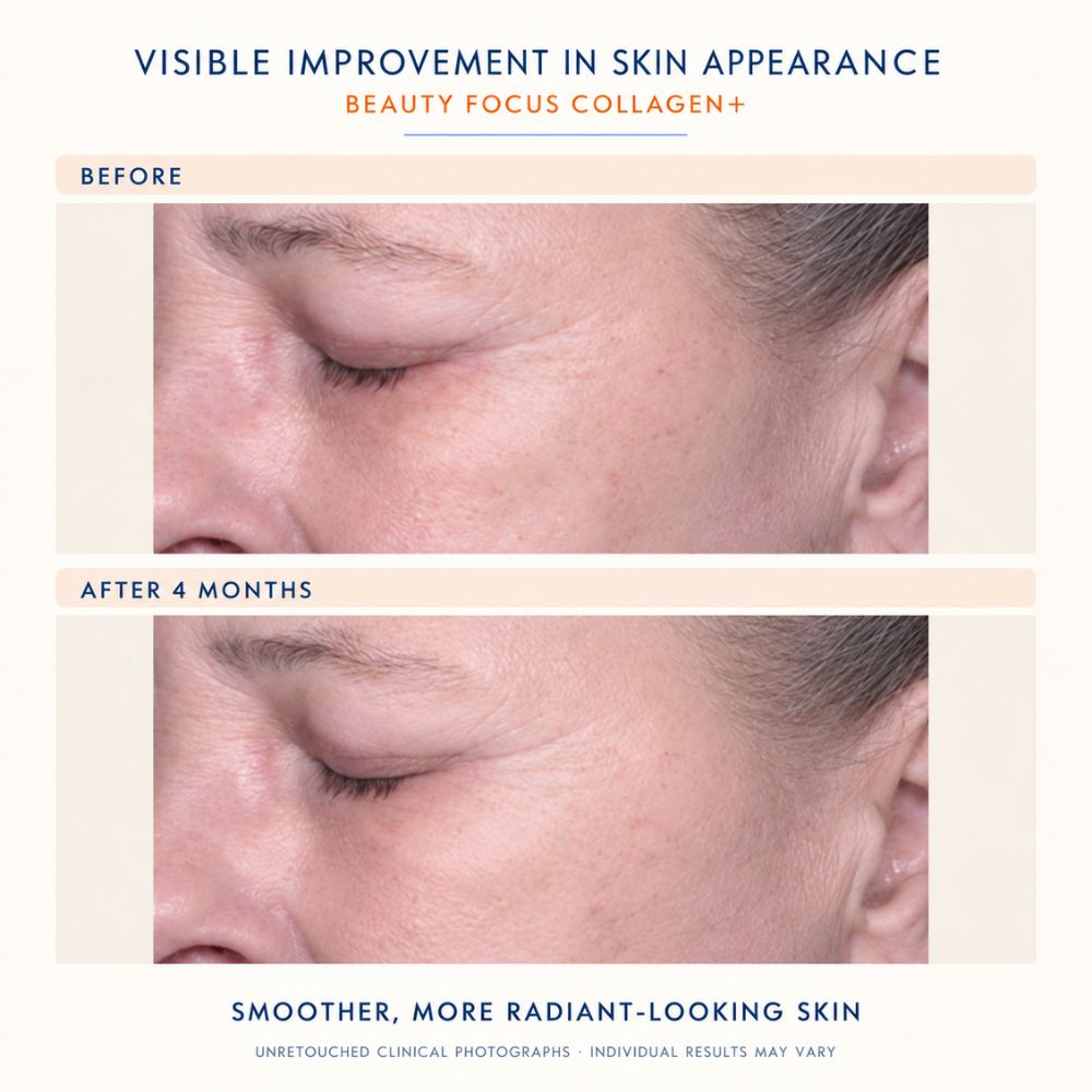 Before-and-after skincare comparison showing a close-up of a woman's eye and cheek area, with text reading 'Before' and 'After 4 months' and the headline 'Visible Improvement in Skin Appearance' and 'Beauty Focus Collagen+'.