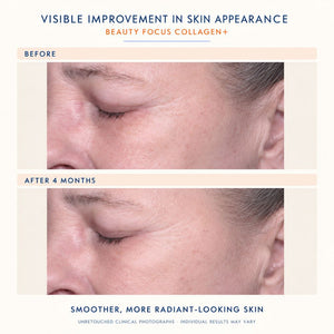 Before-and-after skincare comparison showing a close-up of a woman's eye and cheek area, with text reading 'Before' and 'After 4 months' and the headline 'Visible Improvement in Skin Appearance' and 'Beauty Focus Collagen+'.