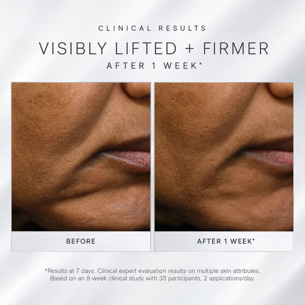 Before-and-after clinical results  using Dermalogica Futurecode Booster Serum, comparison of the lower face and mouth area, showing skin texture and lip area after 1 week. Text at the top reads 'CLINICAL RESULTS VISIBLY LIFTED + FIRMER AFTER 1 WEEK' and labels the panels 'BEFORE' and 'AFTER 1 WEEK'.