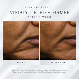 Before-and-after clinical results  using Dermalogica Futurecode Booster Serum, comparison of the lower face and mouth area, showing skin texture and lip area after 1 week. Text at the top reads 'CLINICAL RESULTS VISIBLY LIFTED + FIRMER AFTER 1 WEEK' and labels the panels 'BEFORE' and 'AFTER 1 WEEK'.