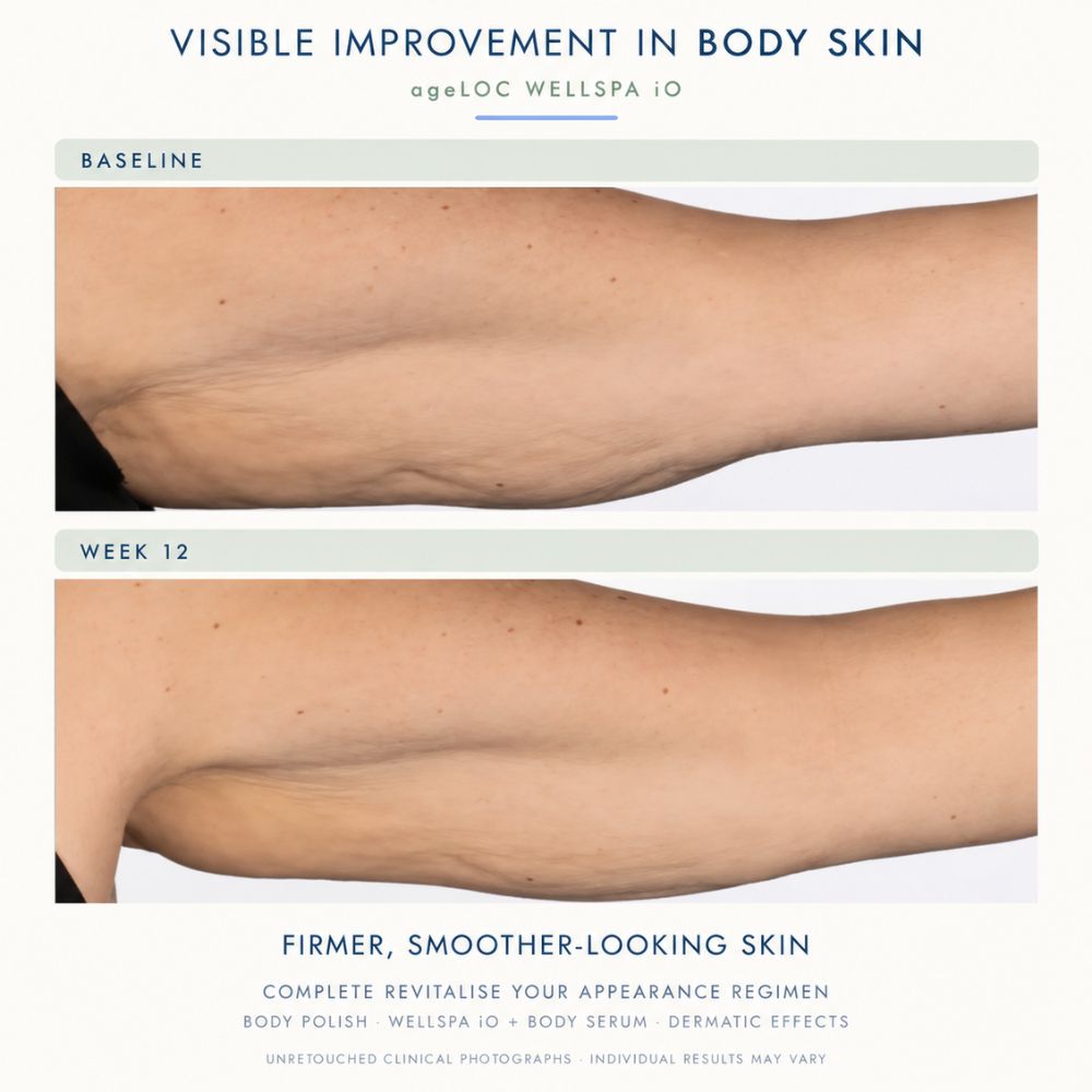 Before-and-after skin comparison showing a person's lower back and hip area, labeled 'BASELINE' and 'WEEK 12', with text reading 'VISIBLE IMPROVEMENT IN BODY SKIN' and 'FIRMER, SMOOTHER-LOOKING SKIN' from ageLOC WELLSPA IO.