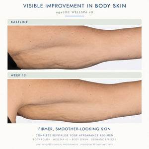 Before-and-after skin comparison showing a person's lower back and hip area, labeled 'BASELINE' and 'WEEK 12', with text reading 'VISIBLE IMPROVEMENT IN BODY SKIN' and 'FIRMER, SMOOTHER-LOOKING SKIN' from ageLOC WELLSPA IO.
