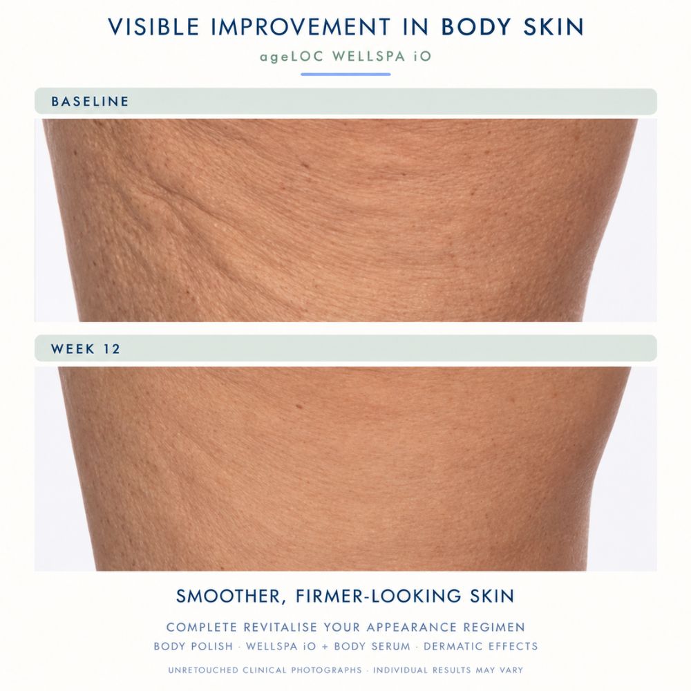 Before-and-after skin comparison using Nu Skin ageLoc Wellspa io, showing a thigh area, labeled 'BASELINE' and 'WEEK 12', with text at the top reading 'VISIBLE IMPROVEMENT IN BODY SKIN' and at the bottom 'SMOOTHER, FIRMER-LOOKING SKIN'.