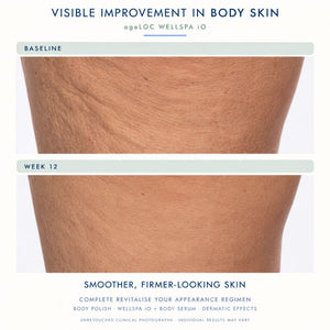 Before-and-after skin comparison using Nu Skin ageLoc Wellspa io, showing a thigh area, labeled 'BASELINE' and 'WEEK 12', with text at the top reading 'VISIBLE IMPROVEMENT IN BODY SKIN' and at the bottom 'SMOOTHER, FIRMER-LOOKING SKIN'.
