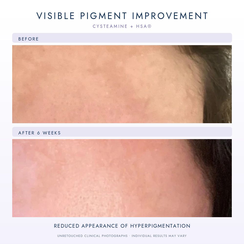Sente Cysteamine HSA Pigment & Tone Correcting Mask 50ml