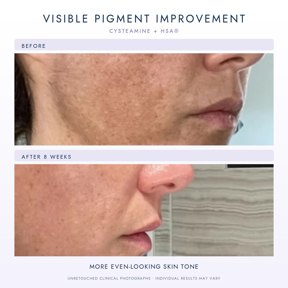 Sente Cysteamine HSA Pigment & Tone Correcting Mask 50ml