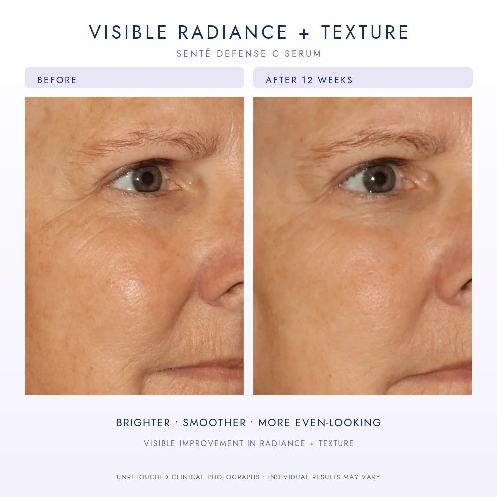 Sente Defence C Serum Before and After for Pigmentation and Radiance.
