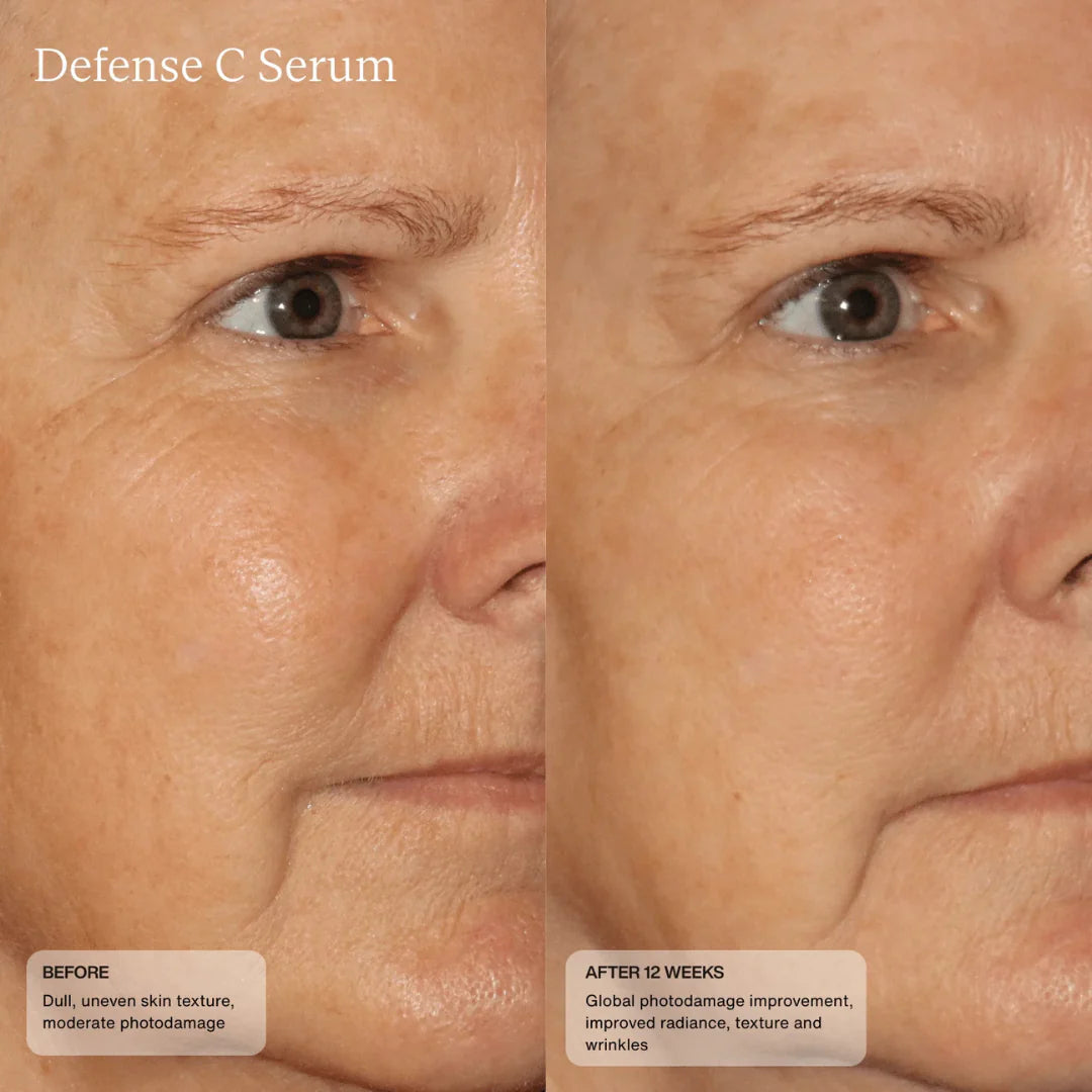 Sente Defense C Serum Before & After