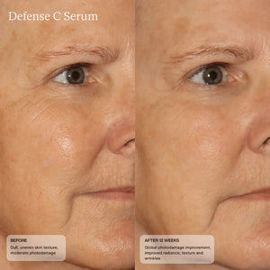 Sente Defense C Serum Before & After
