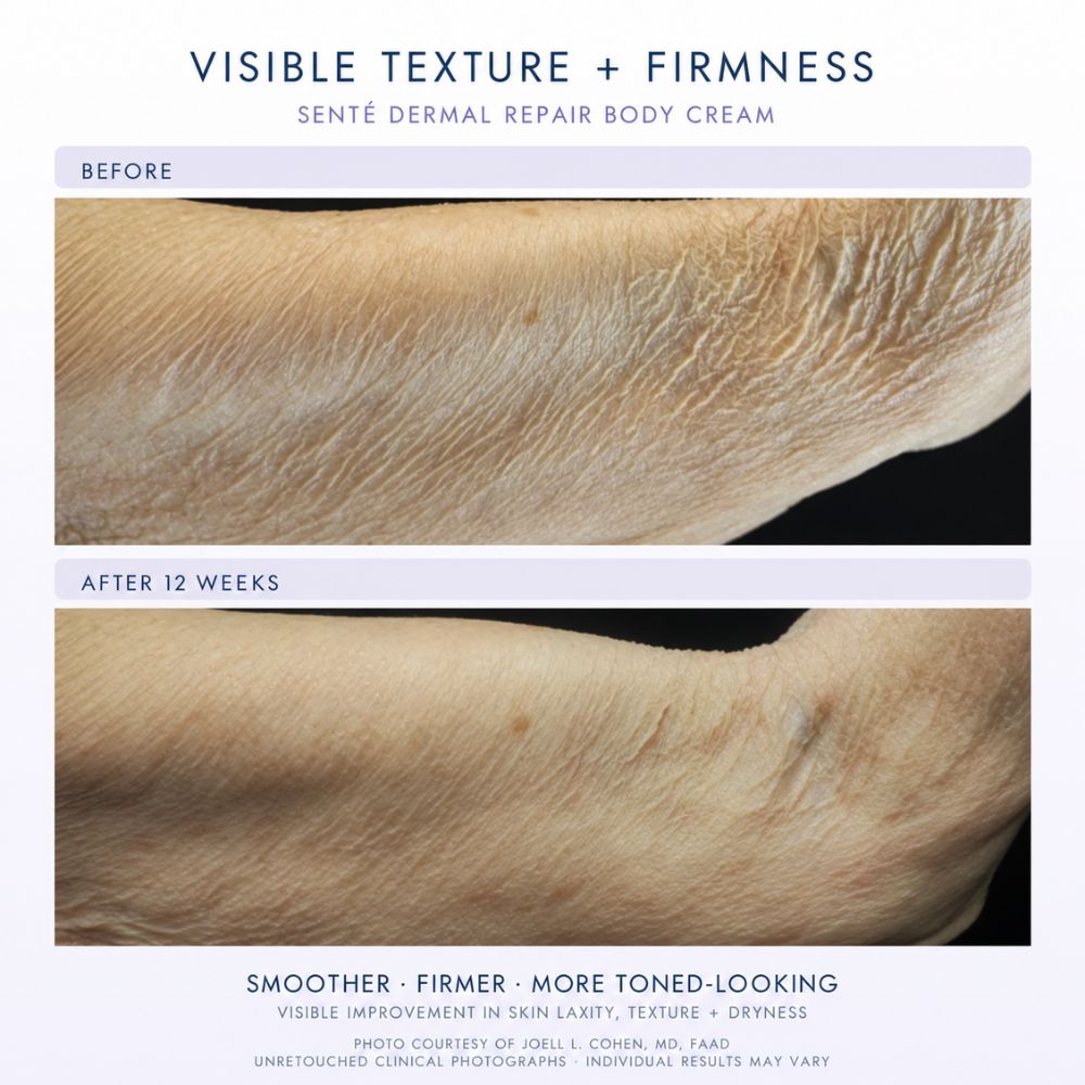 Before-and-after skin comparison showing visible texture and firmness improvement after 12 weeks of use of a dermal repair body cream. The top panel is labeled 'Before' and shows dry, textured skin; the bottom panel is labeled 'After 12 weeks' and shows smoother, firmer skin.