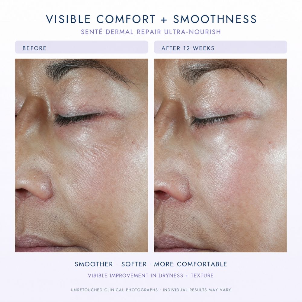 Before-and-after comparison of a person's eye and cheek area showing skin texture improvement over 12 weeks, with text reading 'VISIBLE COMFORT + SMOOTHNESS' and 'SENTÉ DERMAL REPAIR ULTRA-NOURISH'.