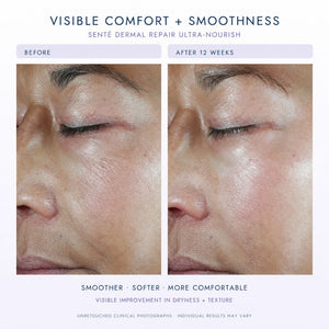 Before-and-after comparison of a person's eye and cheek area showing skin texture improvement over 12 weeks, with text reading 'VISIBLE COMFORT + SMOOTHNESS' and 'SENTÉ DERMAL REPAIR ULTRA-NOURISH'.