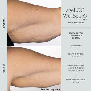 Before and after comparison of skin treatment with ageLOC WellSpa iO system on a white background.