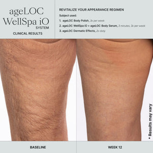 Before and after comparison of legs using ageLOC WellSpa iO system with text on revitalization regimen.